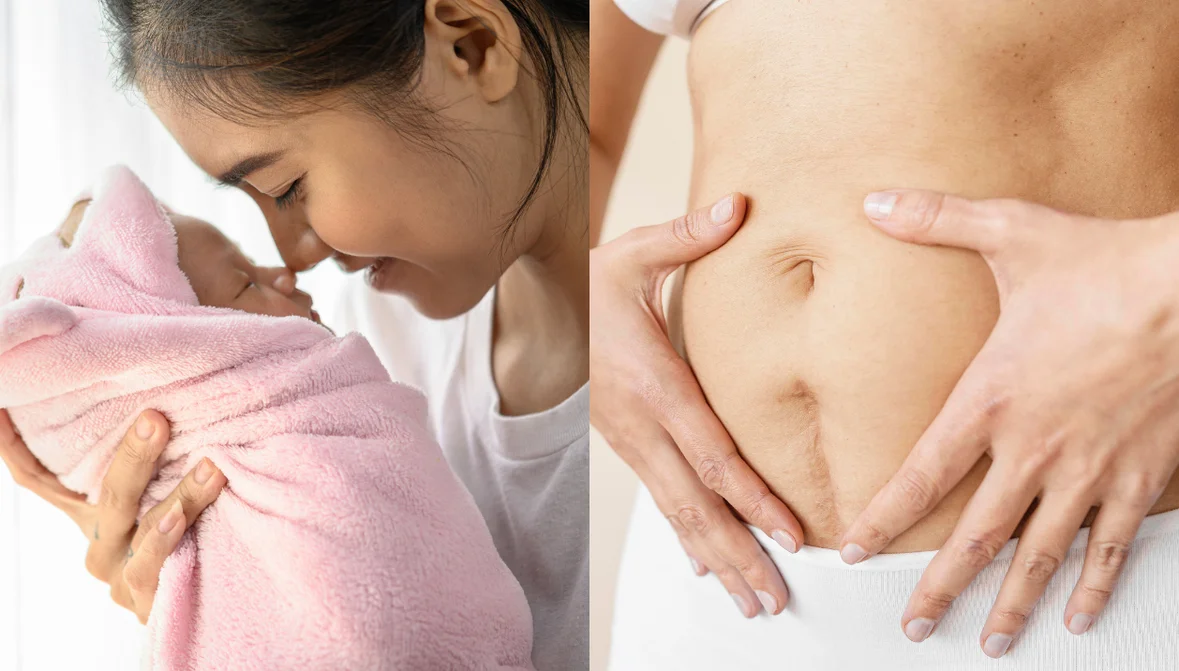 Newborn and mother care